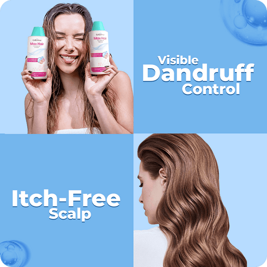 Max Hair Anti-Dandruff Shampoo results