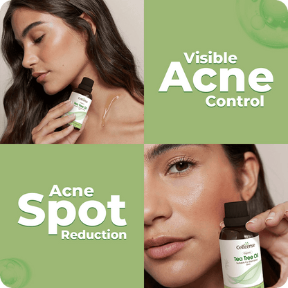 Tea Tree Oil results